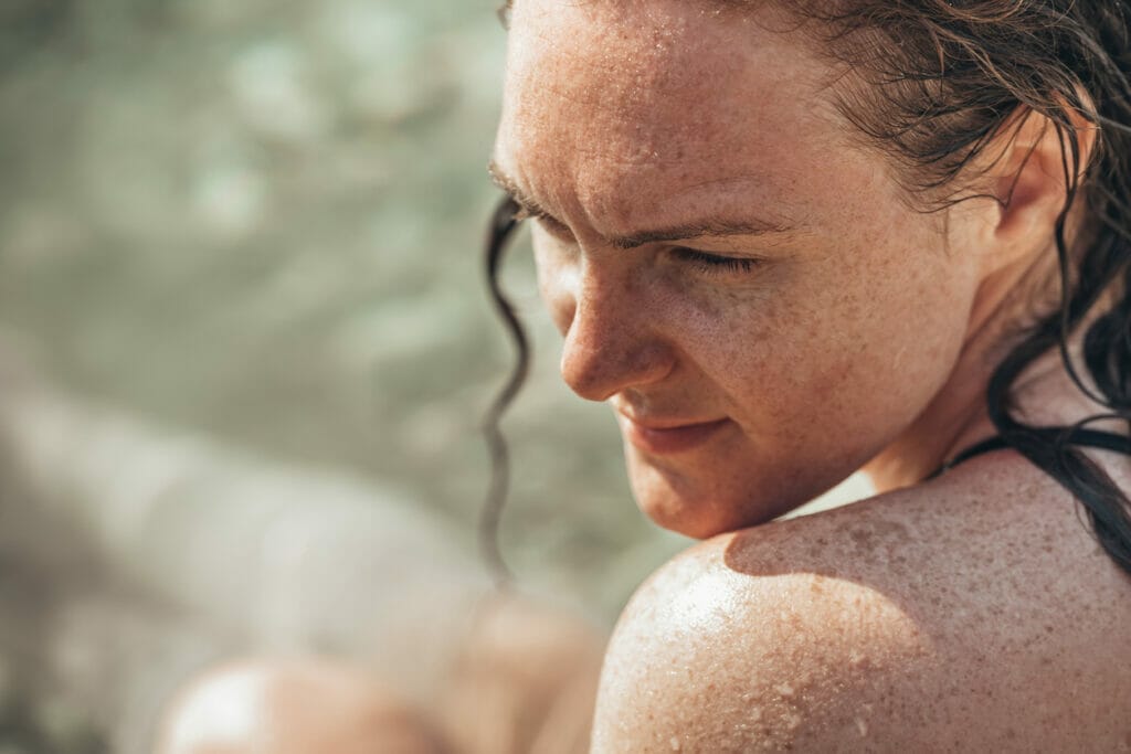 Your freckles make you beautiful Reverse the Signs of Weathering and Sun Damage with IPL?