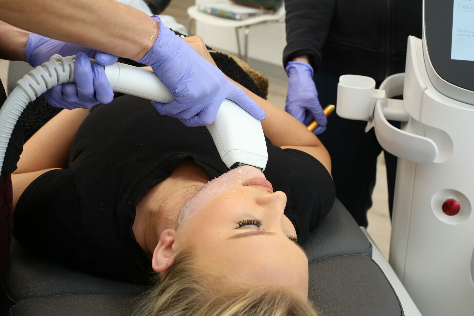 Sofwave from Evolution Dermatology in Boulder CO reduces wrinkles in chin