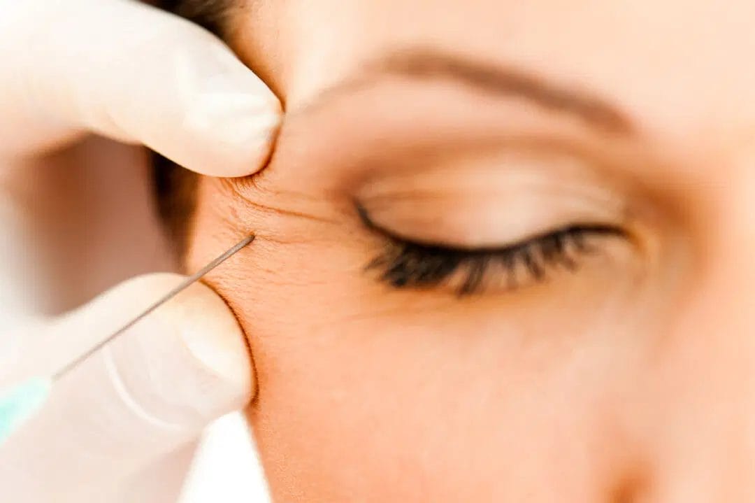 prp for eye area and face