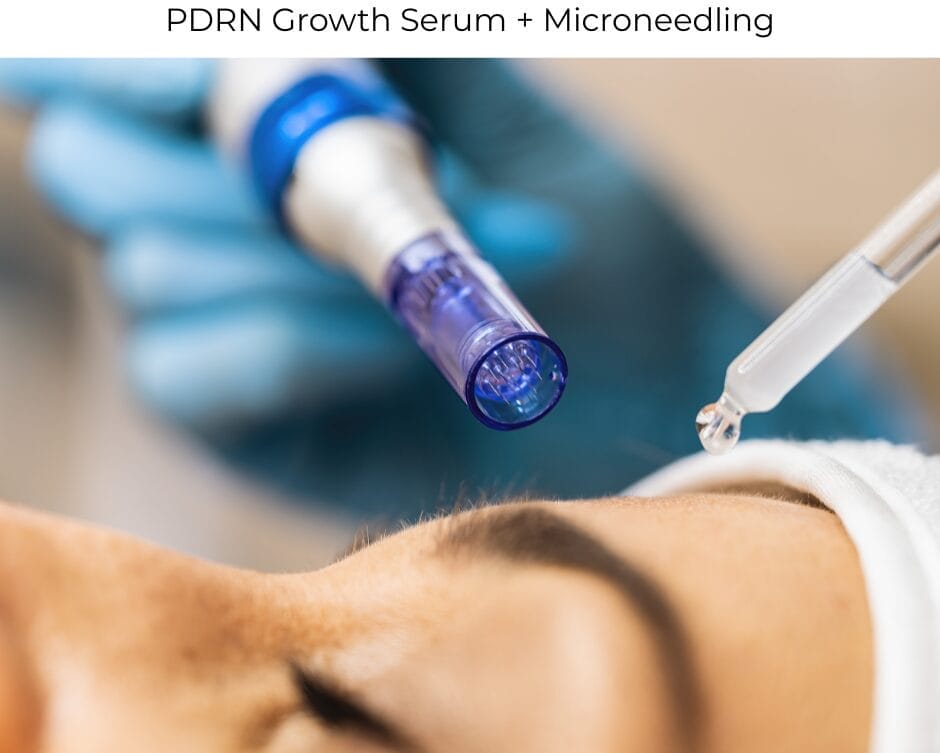 Salmon Sperm Facial